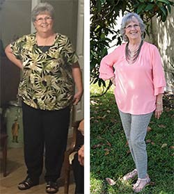 before-and-after-weight-loss